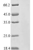Vesicular stomatitis Indiana virus Protein C' (P) Recombinant Protein - BioCrest Sci