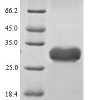 Staphylococcus aureus Enterotoxin type B (entB) Recombinant Protein, N-His - BioCrest Sci