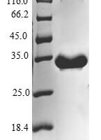 Human Cytochrome b-c1 complex subunit 9 (UQCR10) Recombinant Protein - BioCrest Sci