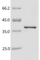Human Hephaestin (HEPH), partial Recombinant Protein - BioCrest Sci