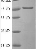 Human Secretory carrier-associated membrane protein 3 (SCAMP3), partial Recombinant Protein - BioCrest Sci