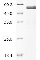 Human Cellular tumor antigen p53 (TP53) Recombinant Protein, N-10His - BioCrest Sci