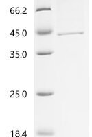 Human Endogenous retrovirus group K member 6 Env polyprotein (ERVK-6), partial Recombinant Protein, N-His - BioCrest Sci
