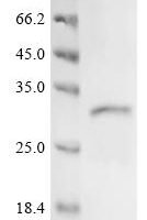 Human Solute carrier family 22 member 1 (SLC22A1), partial Recombinant Protein - BioCrest Sci