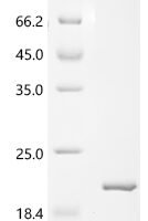 Macaca fascicularis Parathyroid hormone (PTH) Recombinant Protein, C-His - BioCrest Sci
