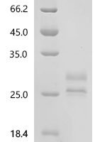 Human Calcium-binding protein p22 (CHP1) Recombinant Protein - BioCrest Sci