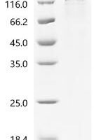 Mouse Myristoylated alanine-rich C-kinase substrate (Marcks) Recombinant Protein, C-hFc1 - BioCrest Sci