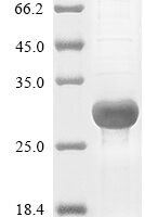 Human Chymotrypsin-like elastase family member 3B (CELA3B) Recombinant Protein - BioCrest Sci