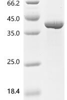 Human MHC class II transactivator (CIITA), partial Recombinant Protein - BioCrest Sci