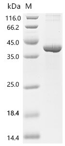 Human MHC class II transactivator (CIITA), partial Recombinant Protein, Homo sapiens (Human), E.coli, C-terminal 6xHis-tagged, 40.9 kDa, purity >≥ 85% as determined by SDS-PAGE.