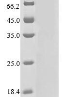 Human Carboxypeptidase D (CPD), partial Recombinant Protein - BioCrest Sci
