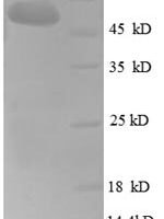Human Fibroblast growth factor 5 (FGF5),partial Recombinant Protein - BioCrest Sci