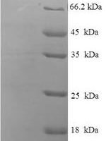 Human Peroxisomal bifunctional enzyme (EHHADH) Recombinant Protein - BioCrest Sci