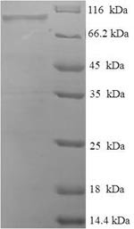 Human Peroxisomal bifunctional enzyme (EHHADH) Recombinant Protein, Homo sapiens (Human), E.coli, N-terminal 6xHis-SUMO-tagged, 95.5 kDa, purity >≥ 90% as determined by SDS-PAGE.