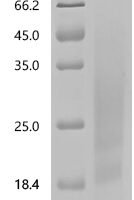 Bovine Alpha-lactalbumin (LALBA) Recombinant Protein, C-His, aa 20–142, Bos taurus (Bovine) - BioCrest Sci