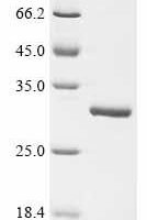 Human Peroxiredoxin-1 (PRDX1) Recombinant Protein, C-His - BioCrest Sci