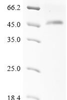 Human NACHT, LRR and PYD domains-containing protein 3 (NLRP3), partial Recombinant Protein, N-His-SUMO - BioCrest Sci
