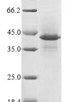 Human HLA class I histocompatibility antigen, alpha chain G (HLA-G) Recombinant Protein, N-His - BioCrest Sci