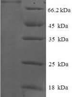 Human Glucokinase regulatory protein (GCKR) Recombinant Protein, N-His-SUMO - BioCrest Sci