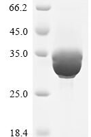 Dermatophagoides pteronyssinus Mite allergen Der p 6 (DERP6) (X4S) Recombinant Protein, C-hFc1 - BioCrest Sci