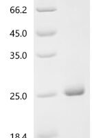 Escherichia coli Putative anti-FlhC (2)FlhD (4) factor YdiV (ydiV) Recombinant Protein - BioCrest Sci