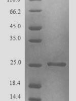 Blattella germanica Glutathione S-transferase Recombinant Protein, N-His - BioCrest Sci