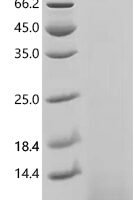 Human Coagulation factor X (F10), partial Recombinant Protein, N-His - BioCrest Sci