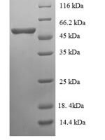 Human Rho guanine nucleotide exchange factor 7 (ARHGEF7), partial Recombinant Protein - BioCrest Sci