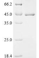 Human F-box/LRR-repeat protein 2 (FBXL2) Recombinant Protein, C-His - BioCrest Sci
