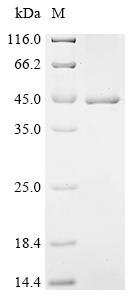 Human F-box/LRR-repeat protein 2 (FBXL2) Recombinant Protein, C-His, Homo sapiens (Human), E.coli, C-terminal 6xHis-tagged, 48.3 kDa, purity >≥ 90% as determined by SDS-PAGE.