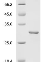 Human Sorting nexin-12 (SNX12) Recombinant Protein, N-10His/C-Myc - BioCrest Sci