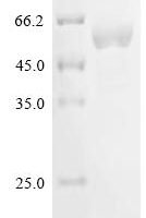 Human Probable global transcription activator SNF2L2  (SMARCA2), partial Recombinant Protein - BioCrest Sci