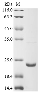Mouse Lymphotoxin-alpha (Lta) Recombinant Protein, Mus musculus (Mouse), E.coli, N-terminal 6xHis-tagged, 23.8 kDa, purity >≥ 85% as determined by SDS-PAGE.