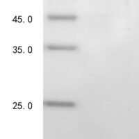 Pig Formimidoyltransferase-cyclodeaminase (FTCD), partial,Biotinylated Recombinant Protein - BioCrest Sci
