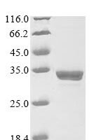 Human metapneumovirus Matrix protein (M) Recombinant Protein, N-10His/C-Myc - BioCrest Sci