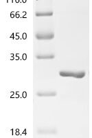 Human MHC class I polypeptide-related sequence B (MICB), partial Recombinant Protein, N-His, aa 25–198 - BioCrest Sci
