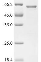 Human Transcriptional regulator ERG (ERG)(Δ239-245) Recombinant Protein - BioCrest Sci