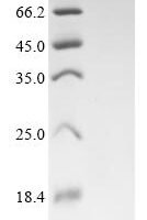 Rat Vesicular glutamate transporter 3 (Slc17a8), partial Recombinant Protein - BioCrest Sci