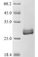 Staphylococcus aureus Serine protease splD (splD) Recombinant Protein - BioCrest Sci