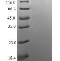 Human Apoptosis regulatory protein Siva (SIVA1) Recombinant Protein, N-His - BioCrest Sci