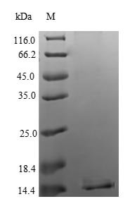 Human Apoptosis regulatory protein Siva (SIVA1) Recombinant Protein, N-His, Homo sapiens (Human), Yeast, N-terminal 6xHis-tagged, 13.8 kDa, purity >≥ 90% as determined by SDS-PAGE.