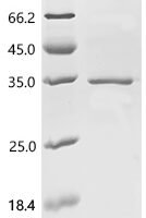 Human Acetylcholine receptor subunit alpha (CHRNA1), partial Recombinant Protein, N-His, aa 21–257 - BioCrest Sci