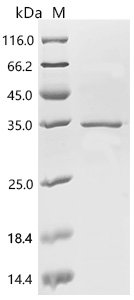 Human Acetylcholine receptor subunit alpha (CHRNA1), partial Recombinant Protein, N-His, aa 21–257, Homo sapiens (Human), E.coli, N-terminal 6xHis-tagged, 34.2 kDa, purity >≥ 85% as determined by SDS-PAGE.