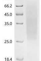 Human Solute carrier organic anion transporter family member 1A2 (SLCO1A2),partial Recombinant Protein, C-His - BioCrest Sci