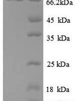 Escherichia coli ATP-dependent DNA helicase recQ (recQ), partial Recombinant Protein - BioCrest Sci