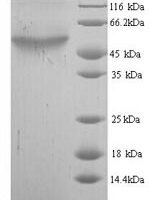 Escherichia coli Cytosine deaminase (codA) Recombinant Protein, N-His - BioCrest Sci