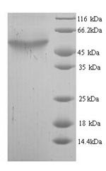 Escherichia coli Cytosine deaminase (codA) Recombinant Protein, N-His, Escherichia coli (strain K12), Yeast, N-terminal 6xHis-tagged, 49.5 kDa, purity >≥ 90% as determined by SDS-PAGE.
