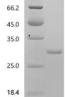 Mouse Sorcin (Sri) Recombinant Protein, N-His, aa 1–198, E.coli - BioCrest Sci