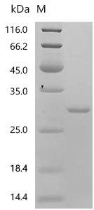 Mouse Sorcin (Sri) Recombinant Protein, N-His, aa 1–198, E.coli, Mus musculus (Mouse), E.coli, N-terminal 6xHis-tagged, 28.5 kDa, purity >≥ 95% as determined by SDS-PAGE.