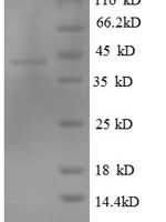 Human Tubulin-specific chaperone C (TBCC) Recombinant Protein - BioCrest Sci